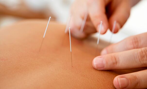 Acupuncture for increased potency